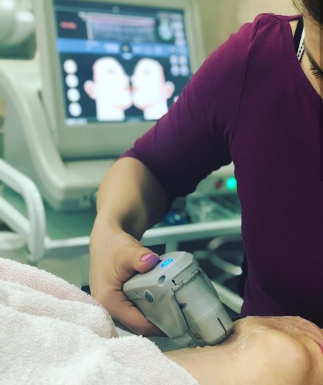 Ultratherapy lifting lica