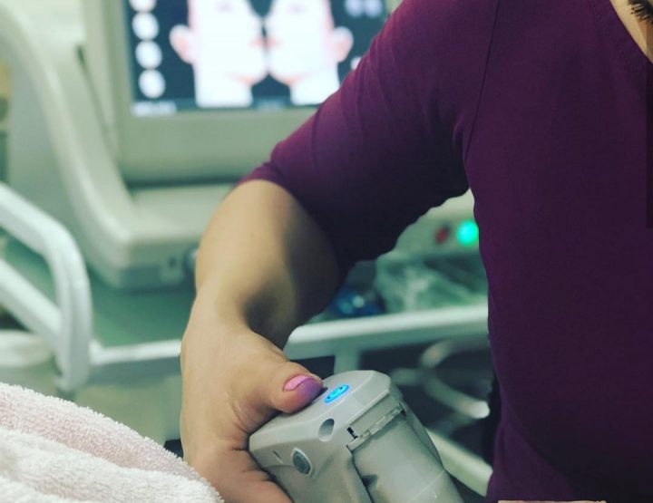 Ultratherapy lifting lica