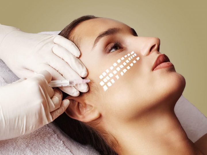 Biorevitalizacija za uklanjanje tragova starenja sa kože!