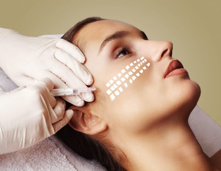 Biorevitalizacija za uklanjanje tragova starenja sa kože!